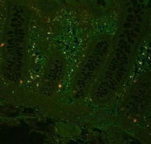 TNF alpha Antibody in Immunohistochemistry (IHC)