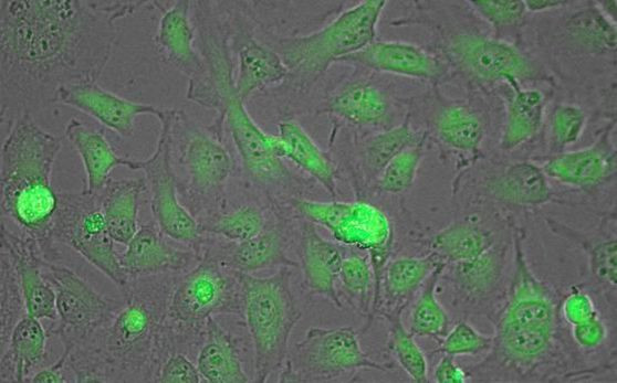 LDHA Antibody in Immunocytochemistry (ICC/IF)