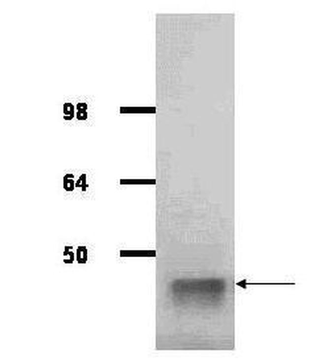 Aldolase A Antibody in Western Blot (WB)