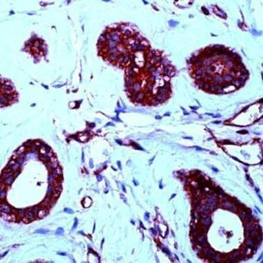 PDGF-B Antibody in Immunohistochemistry (IHC)