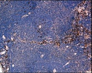 CCR2 Antibody in Immunohistochemistry (Paraffin) (IHC (P))