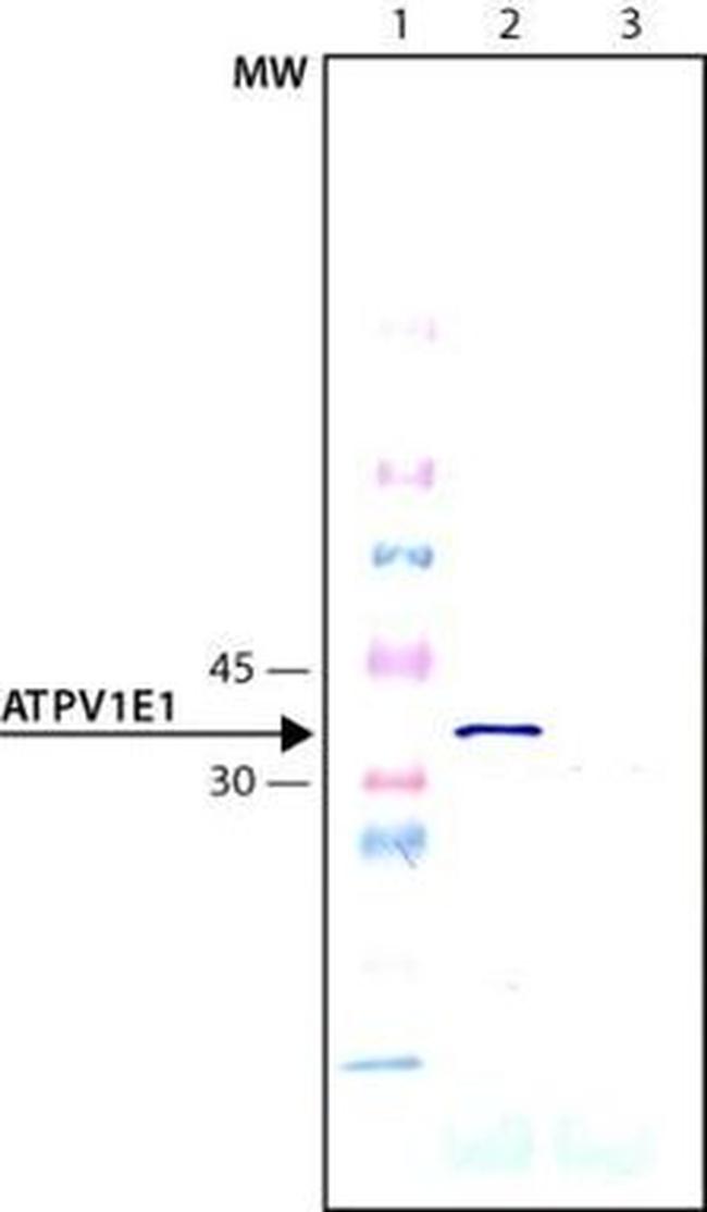 V-ATPase E1 Antibody in Western Blot (WB)