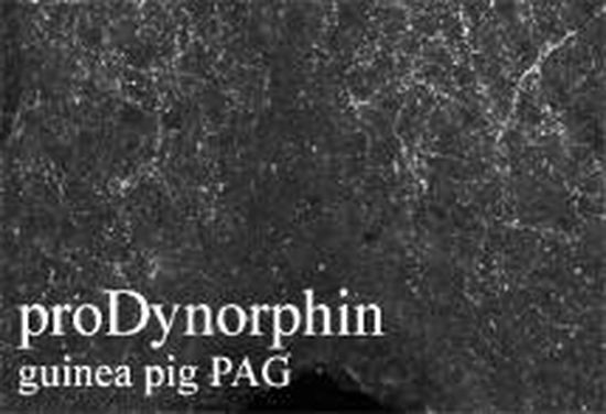 Prodynorphin Antibody in Immunohistochemistry (Frozen) (IHC (F))