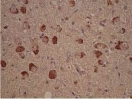 CK1 delta Antibody in Immunohistochemistry (Paraffin) (IHC (P))