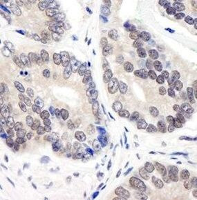 COPS3 Antibody in Immunohistochemistry (Paraffin) (IHC (P))