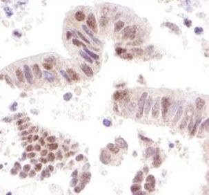 CoAA Antibody in Immunohistochemistry (Paraffin) (IHC (P))