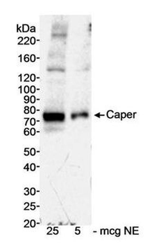 HCC1 Antibody in Western Blot (WB)