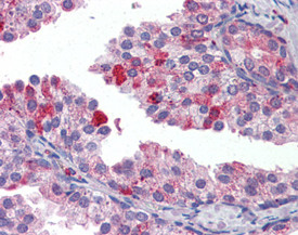 TAP1 Antibody in Immunohistochemistry (IHC)