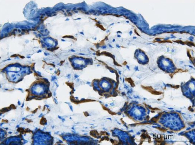 Collagen IV Antibody in Immunohistochemistry (Paraffin) (IHC (P))