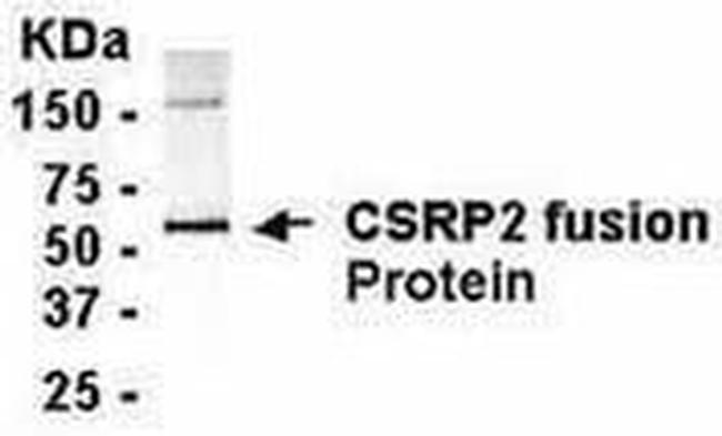 CRP2 Antibody in Western Blot (WB)