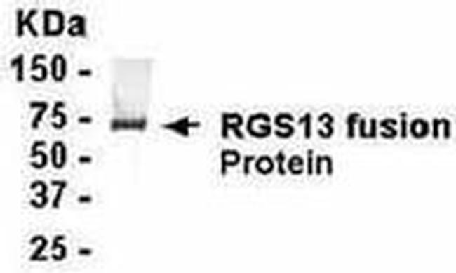 RGS13 Antibody in Western Blot (WB)