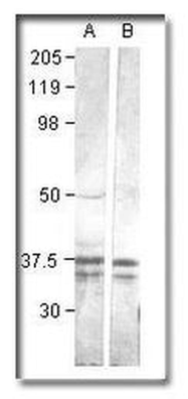 CaMKI Antibody in Western Blot (WB)