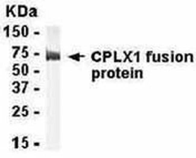 CPLX1 Antibody in Western Blot (WB)