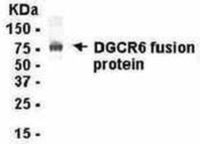 DGCR6 Antibody in Western Blot (WB)