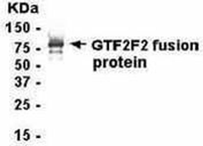 GTF2F1 Antibody in Western Blot (WB)