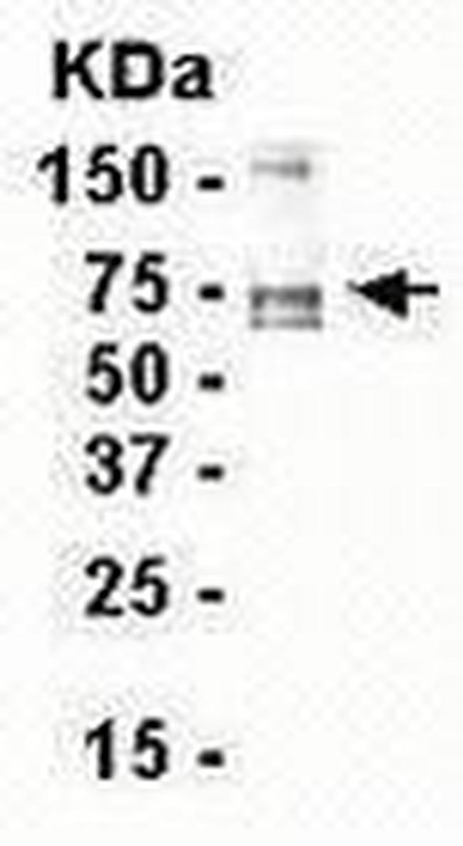 Tenascin C Antibody in Western Blot (WB)