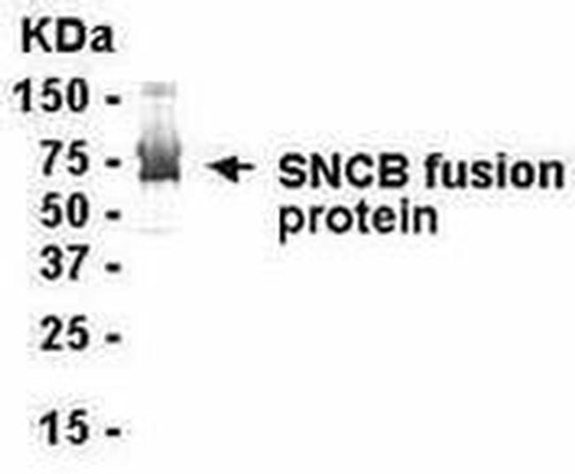 beta Synuclein Antibody in Western Blot (WB)