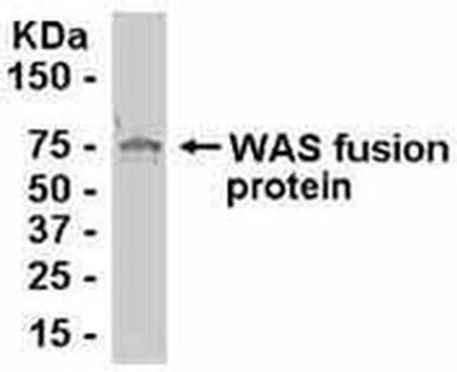 WASP Antibody in Western Blot (WB)
