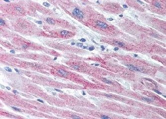 SOCS2 Antibody in Immunohistochemistry (IHC)