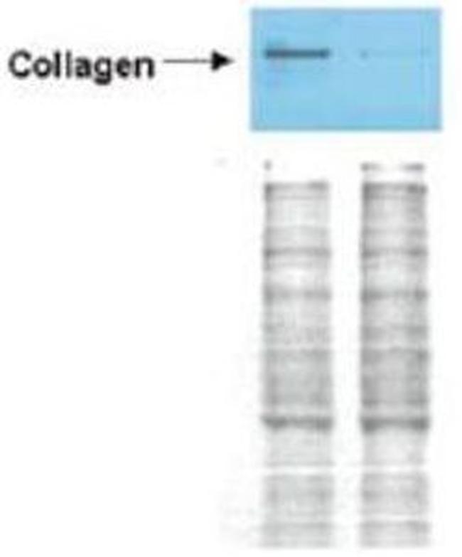 Collagen I Antibody in Western Blot (WB)