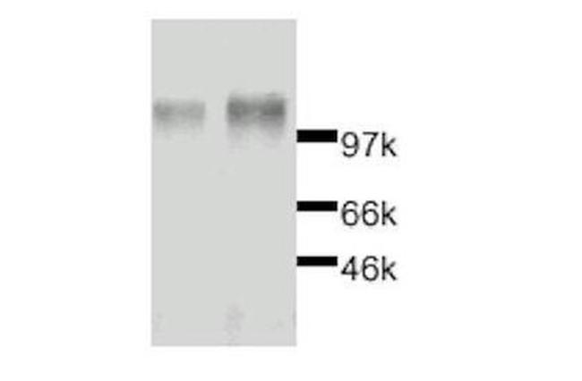 Leptin Receptor Antibody in Western Blot (WB)