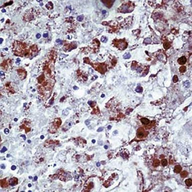 HSV Type 1 Antibody in Immunohistochemistry (Paraffin) (IHC (P))