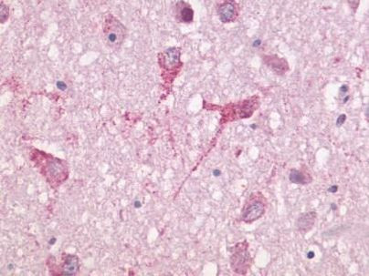 Lactoferrin Antibody in Immunohistochemistry (IHC)