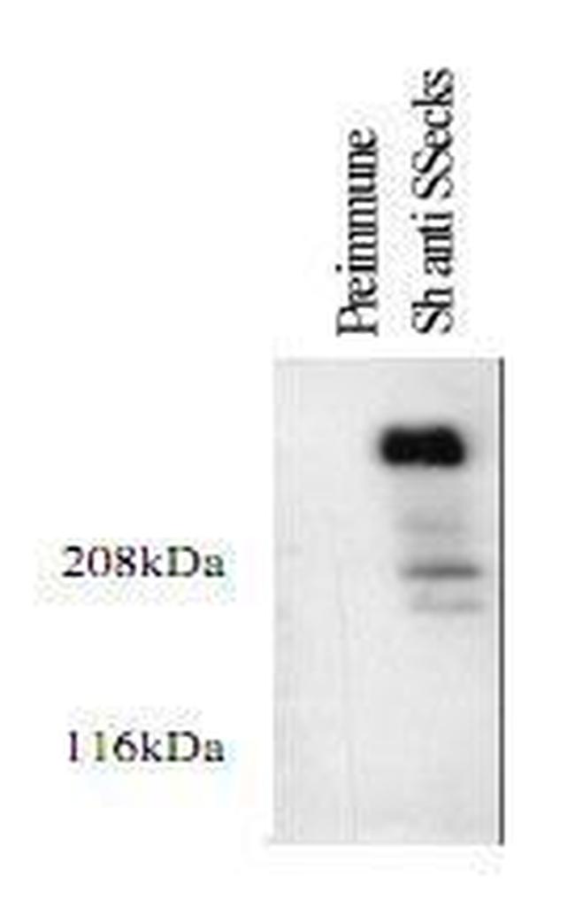 AKAP12 Antibody in Western Blot (WB)