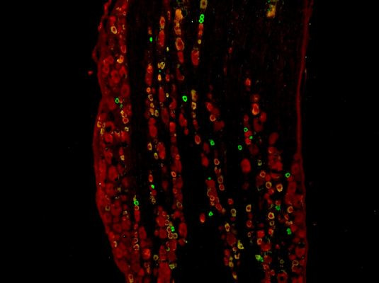 TRPV1 Antibody in Immunohistochemistry (Frozen) (IHC (F))