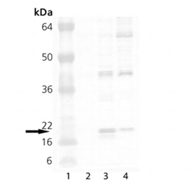 HSP20 Antibody in Western Blot (WB)