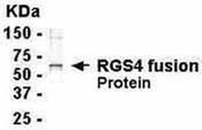 RGS4 Antibody in Western Blot (WB)