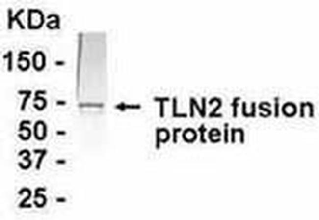 Talin 2 Antibody in Western Blot (WB)