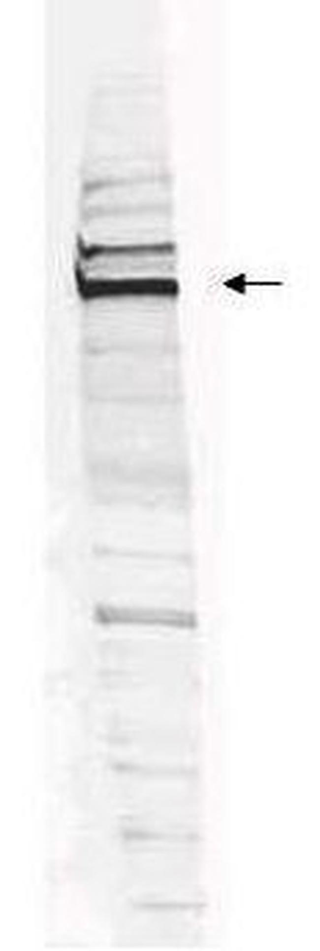 WHIP Antibody in Western Blot (WB)