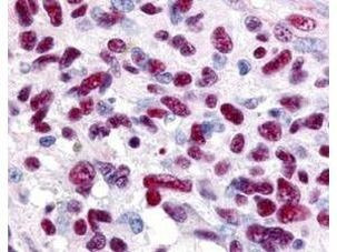 GLI3 Antibody in Immunohistochemistry (Paraffin) (IHC (P))