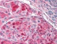 MAGE1 Antibody in Immunohistochemistry (Paraffin) (IHC (P))