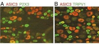 P2X3 Antibody in Immunocytochemistry (ICC/IF)