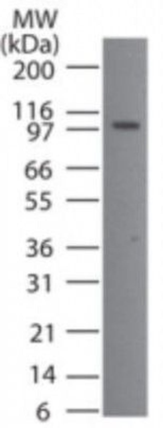 TMEM123 Antibody in Western Blot (WB)