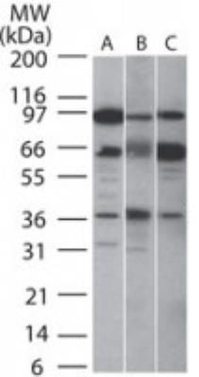 SIRT5 Antibody in Western Blot (WB)
