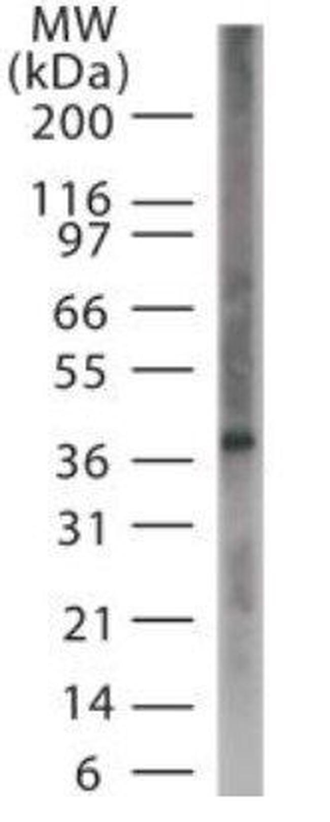 ASB11 Antibody in Western Blot (WB)