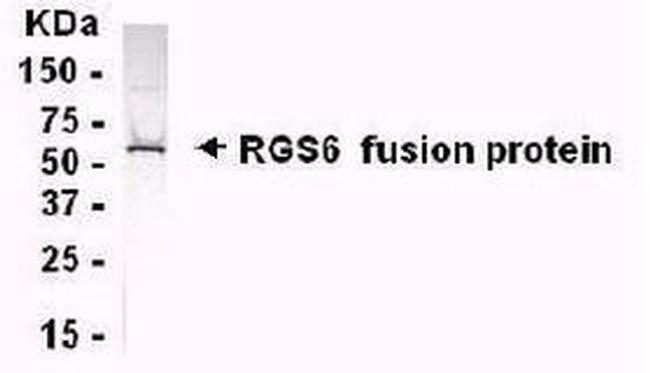 RGS6 Antibody in Western Blot (WB)