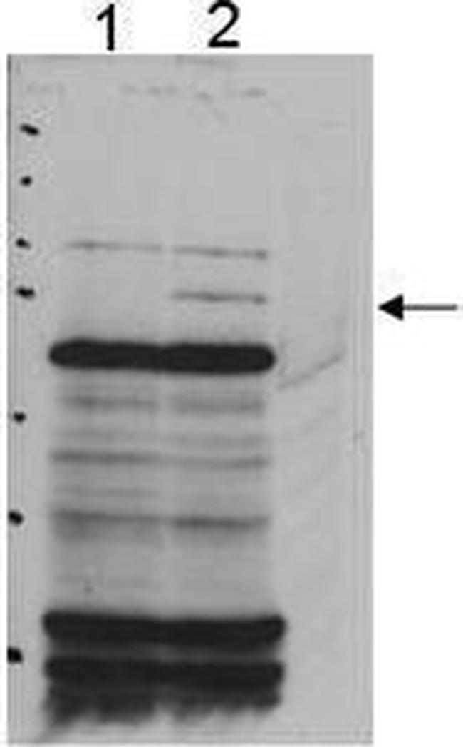PNK Antibody in Western Blot (WB)