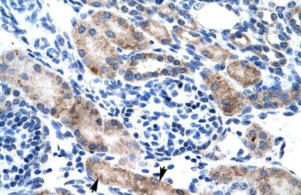 CLIC1 Antibody in Immunohistochemistry (Paraffin) (IHC (P))