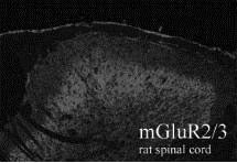 mGluR2/mGluR3 Antibody in Immunohistochemistry (IHC)