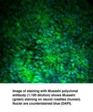 MSI1 Antibody in Immunocytochemistry (ICC/IF)