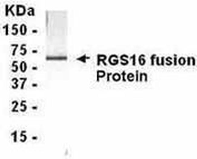RGS16 Antibody in Western Blot (WB)