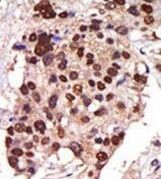 PRKD3 Antibody in Immunohistochemistry (Paraffin) (IHC (P))