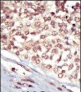 EphA5 Antibody in Immunohistochemistry (Paraffin) (IHC (P))