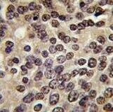 PKN3 Antibody in Immunohistochemistry (Paraffin) (IHC (P))