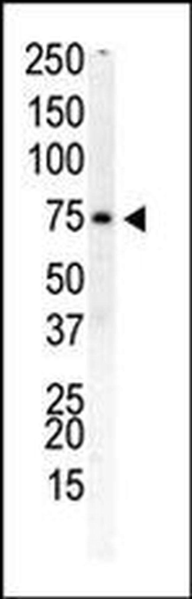 PIP5K1B Antibody in Western Blot (WB)