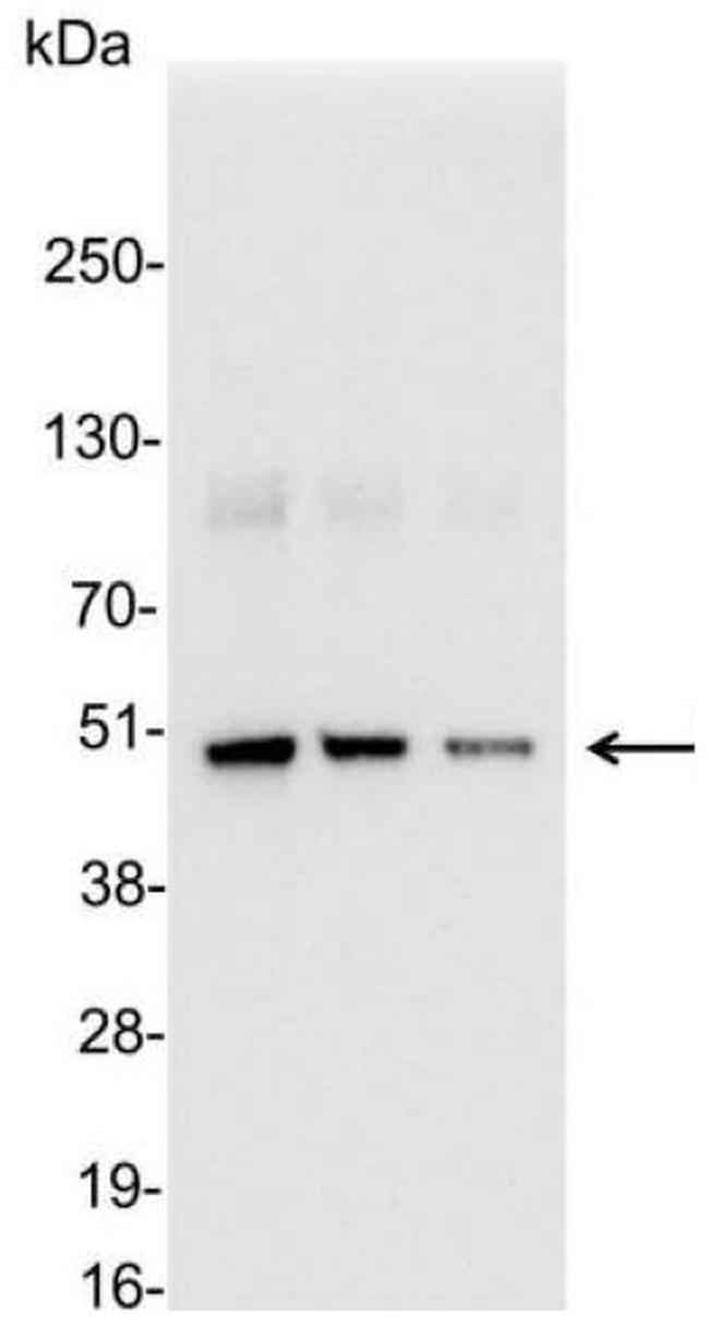 Enterokinase Cleavage Site Antibody in Western Blot (WB)